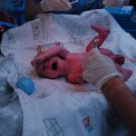 Welcome to the world